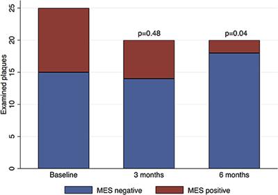 The Course of Carotid Plaque Vulnerability Assessed by Advanced Neurosonology